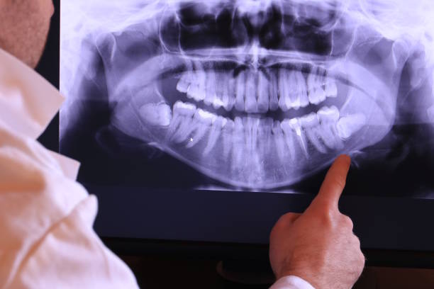 Best Tooth Infection Emergency Dentist  in Bent Creek, NC