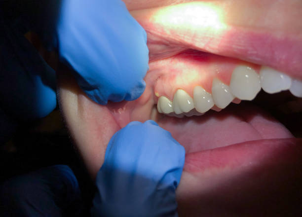 Best Tooth Pain Emergency Relief  in Bent Creek, NC